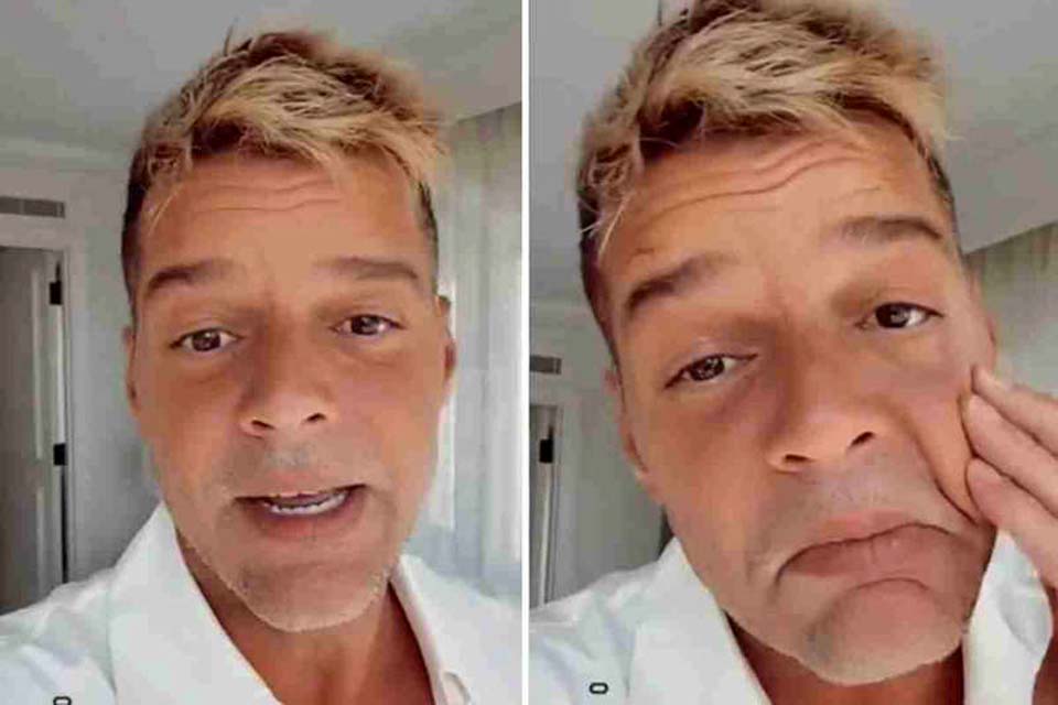 Ricky Martin nega harmonização facial após críticas: “Não mexo na cara”